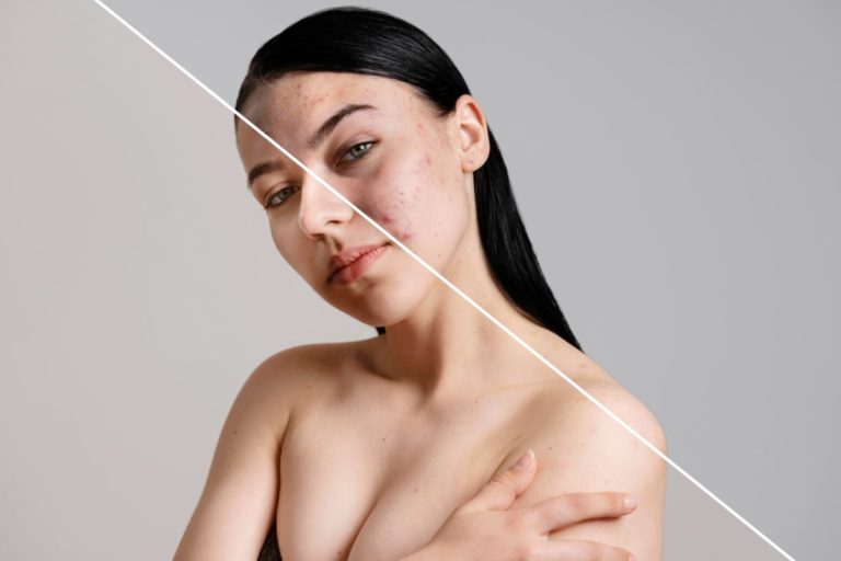 Read more about the article Conubia nostra per inceptos